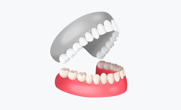 Нижняя челюсть